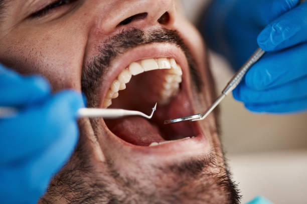Best Urgent Tooth Repair  in Bloomer, WI